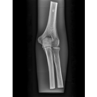 X-Ray Phantom Elbow, Opaque
