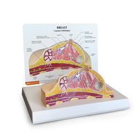 Anatomical Model- Breast Cross-section