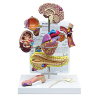 Anatomical Model- Type II Diabetes Set