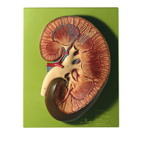 Somso Right Kidney Model
