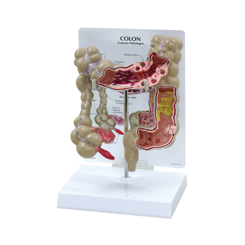 Anatomical Model- Colon