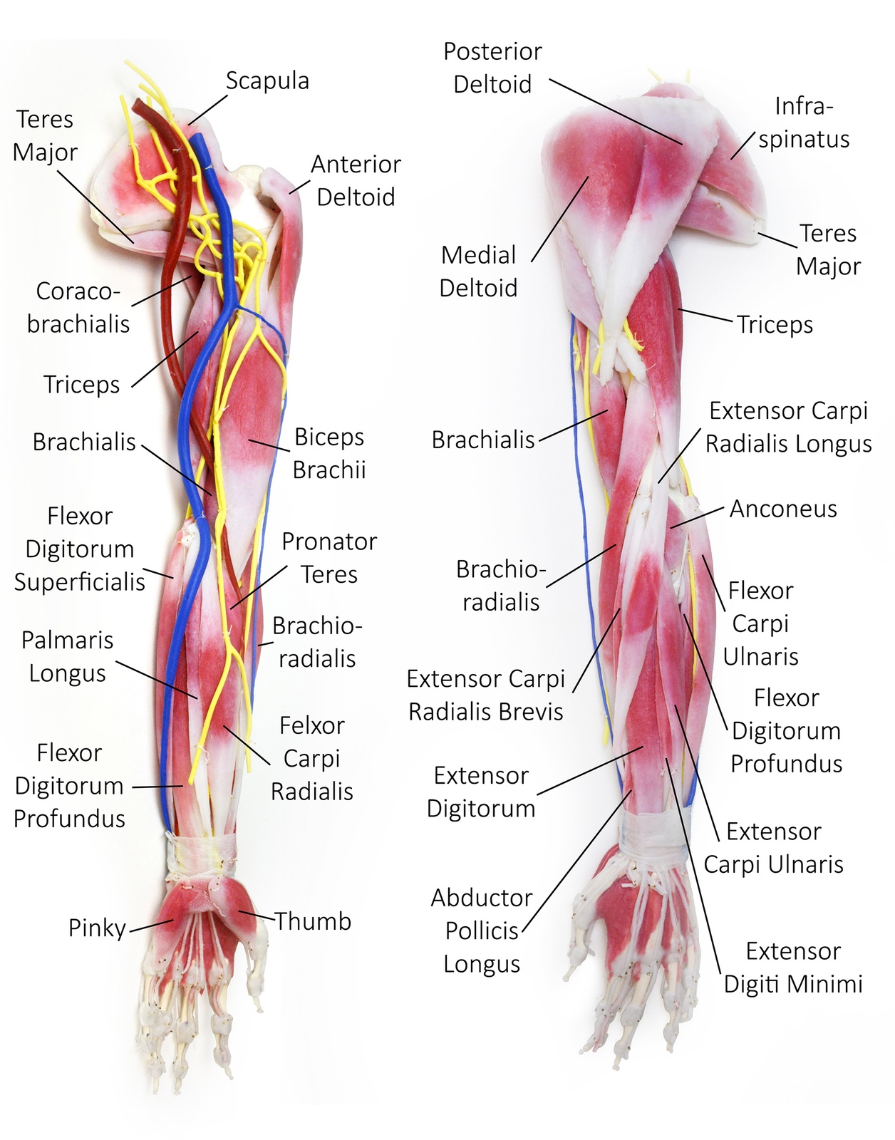 Synthetic Cadaver - Anatomy Arm