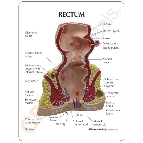 Anatomical Model Rectum Anatomical Model Rectum
