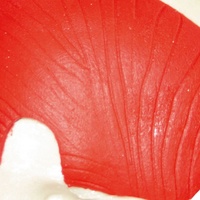 PHACON Neuro Patient “Becker” – Calvarium