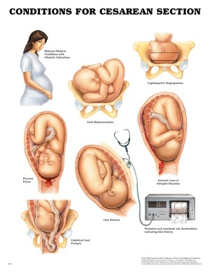 Sexually Transmitted Infections Anatomical Chart