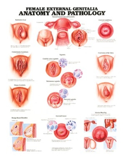 Anatomical Chart- Female External Genitalia Anatomy & Pathology