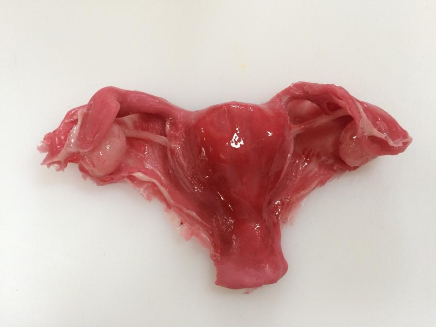 MO715 Realistic Uterus And Ovaries