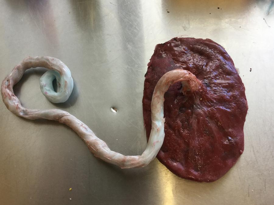 What Is The Placenta