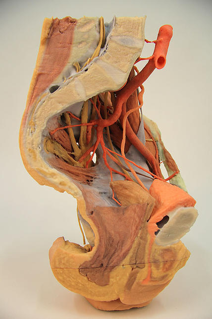 Anatomical Model- Female left pelvis and proximal thigh