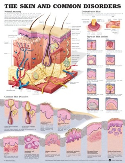 anatomical chart the skin and common disorders skin disorders chart