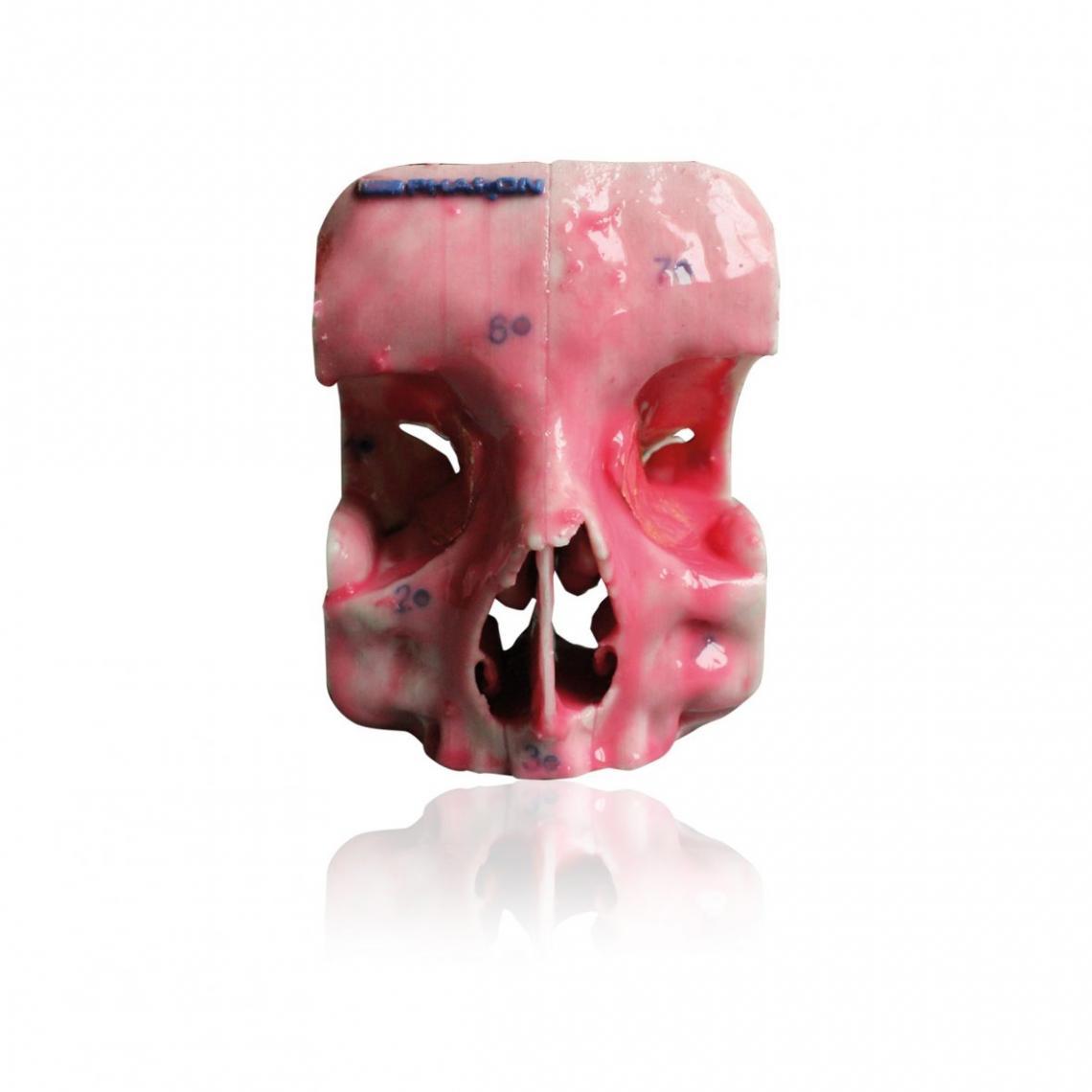 PHACON Sinus Patient “Schulze” (SN-ba)