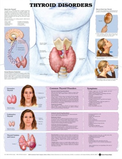 Chart Of Endocrine Disorders