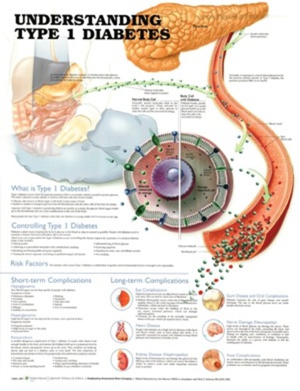 Anatomical Chart- Understanding Type 1 Diabetes