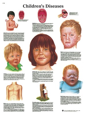 Anatomical Models and Children's Diseases Chart