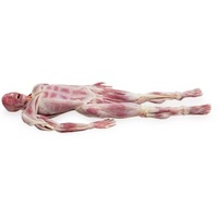 Synthetic Cadaver- SynDaver Musculoskeletal Model