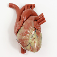 CABG Beating Heart with Ancillary