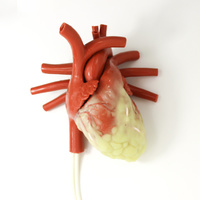 Larger Adult CABG Beating Heart with Ancillary