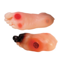 Diabetic Foot Model Set