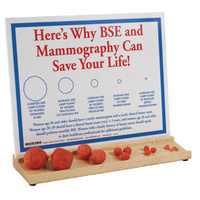 Interactive Breast Lump Display