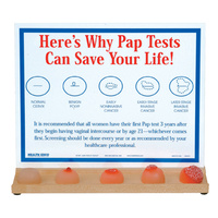 Feel for Yourself: Cervix Conditions Display
