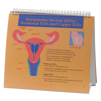 Understanding Birth Control Flip Chart