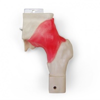Hip Labrum Replacement Joint with Capsule