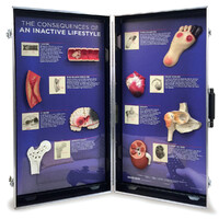 Consequences of an Inactive Lifestyle 3D Display