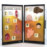 The Consequences of Alcohol Abuse 3D Display