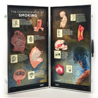 The Consequences of Smoking 3D Display
