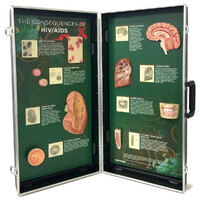 The Consequences of HIV/AIDS 3-D Display