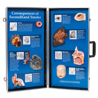 The Consequences of Second hand Smoke 3D Display