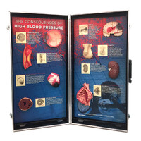 The Consequences of High Blood Pressure
