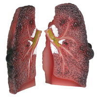 Cough Up a Lung Model