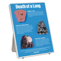 Death of a Lung Easel Display