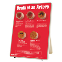 Death of an Artery Easel Display