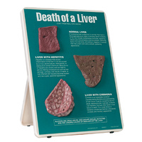 Death of a Liver Easel Display