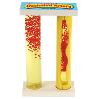 Deluxe Occluded Artery Model