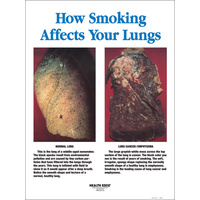 How Smoking Affects Your Lungs Framed Chart