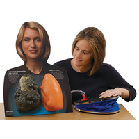 Lou-Wheeze Smoker's Lungs Comparison Model