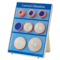 Cervical Dilatation Easel Display