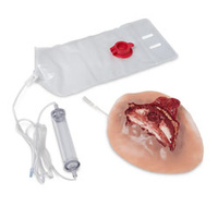 Wound - Open Rib Fracture