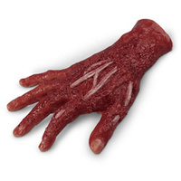 Wound - Chemical Burn, 4th Degree, Right Hand