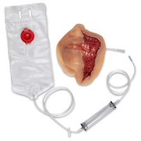 Wound - Exposed Denture Avulsion