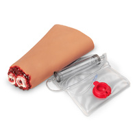 Wound - Hand Amputation