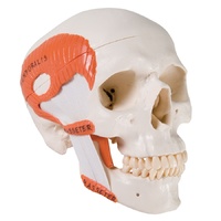 Anatomical Model- TMJ Human Skull Model, demonstrates functions of masticator muscles, 2 part