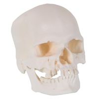 Anatomical Model- Microcephalic Human Skull Model