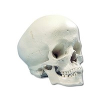 Anatomical Model- Hydrocephalic Human Skull Model