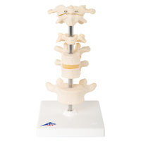 Anatomical Model of 6 Vertebrae on Stand