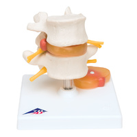 Anatomical Lumbar Spinal Column
