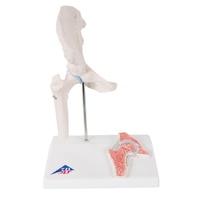 Anatomical Mini Hip Joint with Cross-section Model